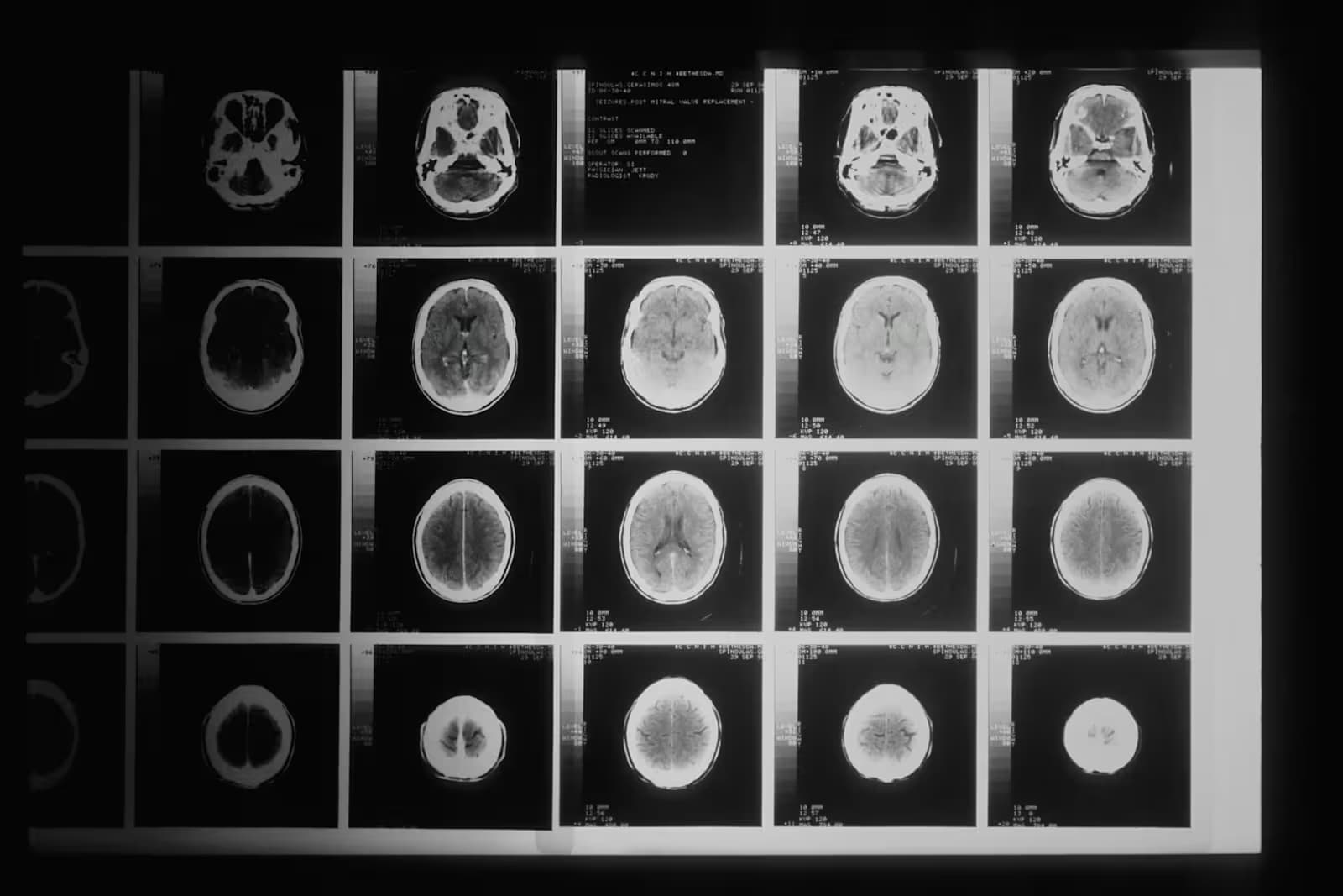 Neurosurgery clinical setting