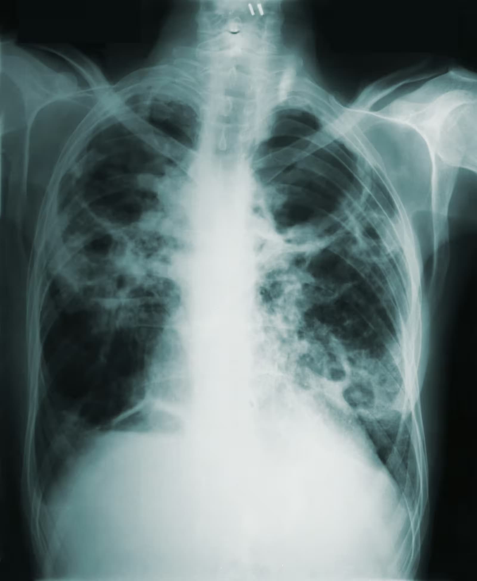 Pulmonology clinical setting