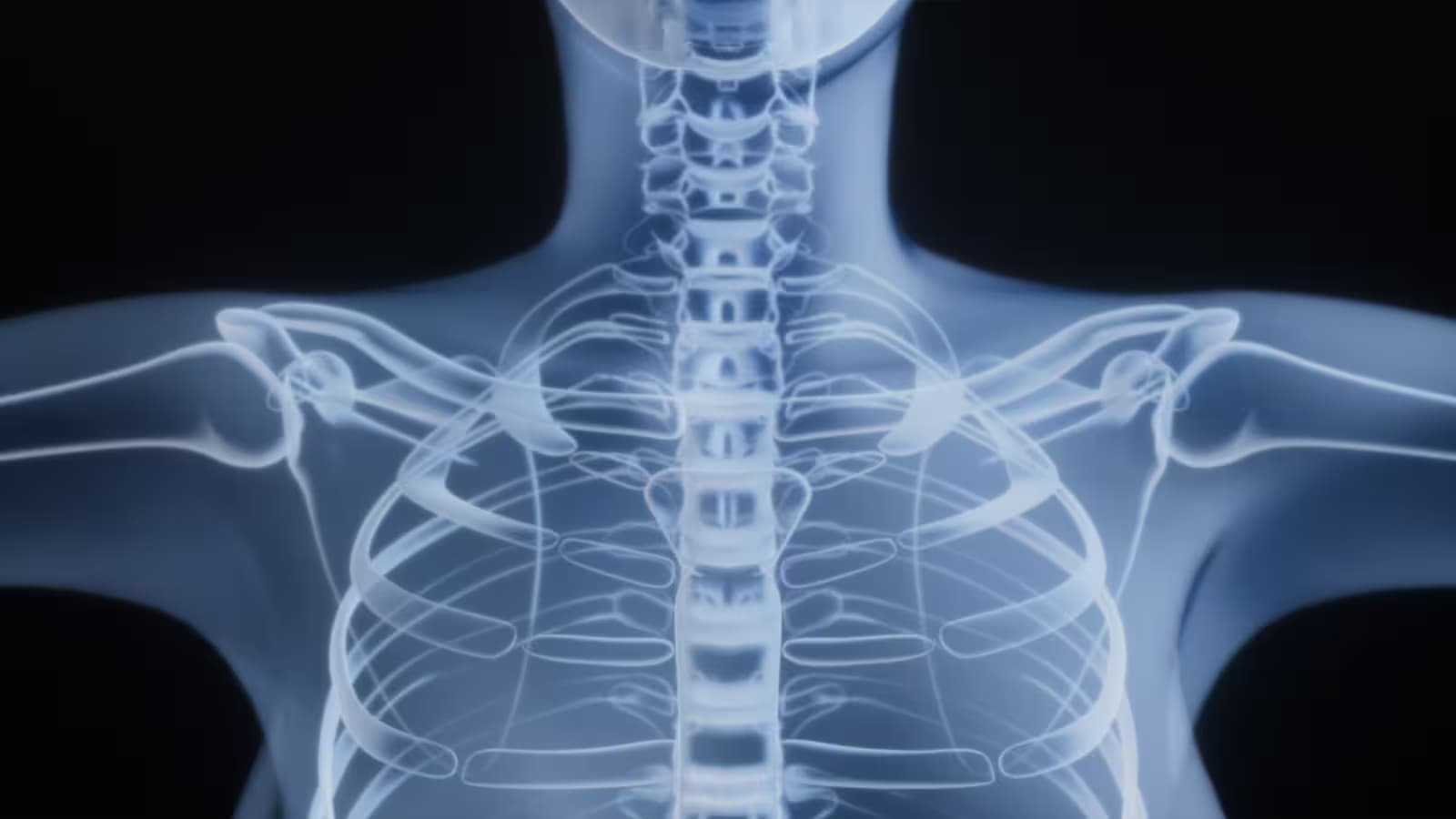 Thoracic Surgery clinical setting