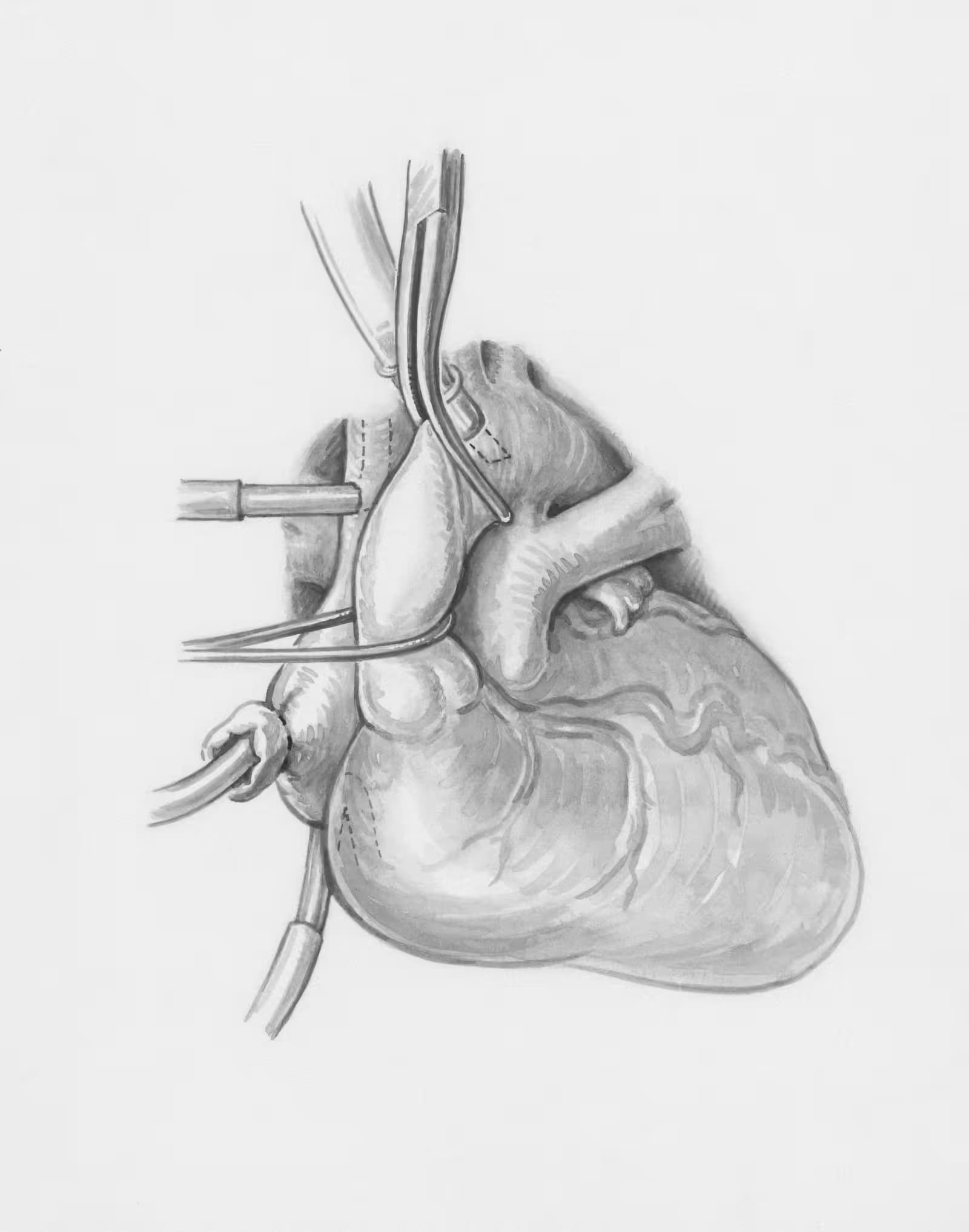 Vascular Surgery clinical setting